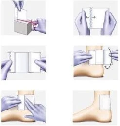 Hartmann - Omnifix - Elastic Fixatieverband - 5cm X 10 Meter -Winkel Voor Ehbo-Apparatuur 1138x1200