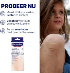 Hansaplast Zelfhechtende Vingerbandage - 5m X 2,5 Cm - Op Maat Knipbaar 12 Hansaplast Zelfhechtende Vingerbandage - 5m X 2,5 Cm - Op Maat Knipbaar -Winkel Voor Ehbo-Apparatuur 1154x1200 2