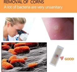 Wratten Pleisters - Tegen Druk - Anti Eelt Pleisters - 6 Stuks - Wrattenpleister - Eeltpleister -Winkel Voor Ehbo-Apparatuur 1200x1123