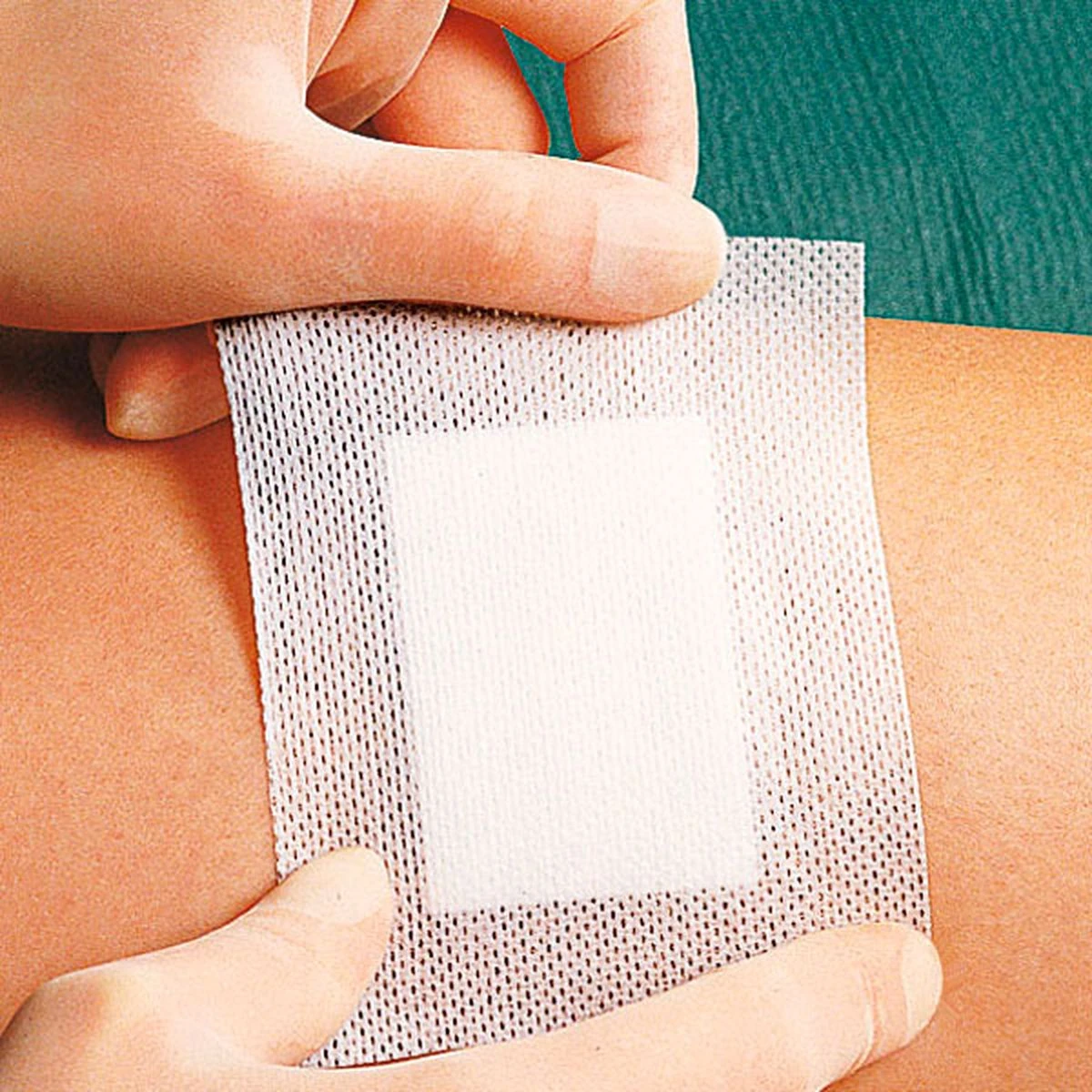 Eilandpleisters - Chirurgisch Wondverband - 10x8cm - 5 Stuks 2 Eilandpleisters - Chirurgisch Wondverband - 10x8cm - 5 Stuks - Afbeelding 2