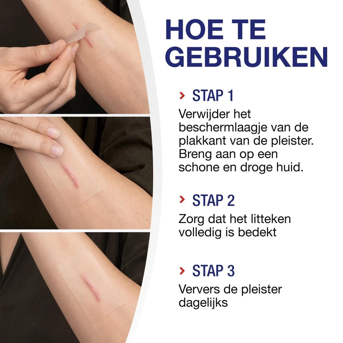 Hansaplast Littekenvervager - Vermindert Zichtbaarheid Van Littekens - 21 Stuks 3 Hansaplast Littekenvervager - Vermindert Zichtbaarheid Van Littekens - 21 Stuks - Afbeelding 3