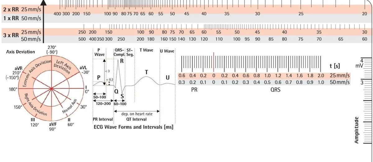 Merkloos ECG Liniaal / Meetlat Transparant 1 Merkloos ECG Liniaal / Meetlat Transparant