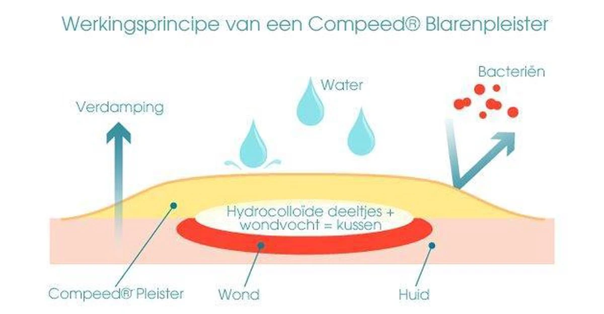 Compeed Mixpack - 5 Stuks - Blarenpleisters 4 Compeed Mixpack - 5 Stuks - Blarenpleisters - Afbeelding 4
