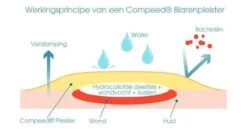 Compeed Op Tenen - 8 St - Blarenpleisters -Winkel Voor Ehbo-Apparatuur 1200x625