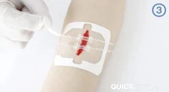 QuickStitch Dubbele Hechtpleister – Naaldloze Hechting – Pleister Voor Diepe Wonden - Pleisters – Zelf Hechtpleister – Snelle Manier Om Wonden Af Te Sluiten – 3 Stuks
