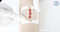 QuickStitch Dubbele Hechtpleister – Naaldloze Hechting – Pleister Voor Diepe Wonden - Pleisters – Zelf Hechtpleister – Snelle Manier Om Wonden Af Te Sluiten – 3 Stuks -Winkel Voor Ehbo-Apparatuur 1200x658 3