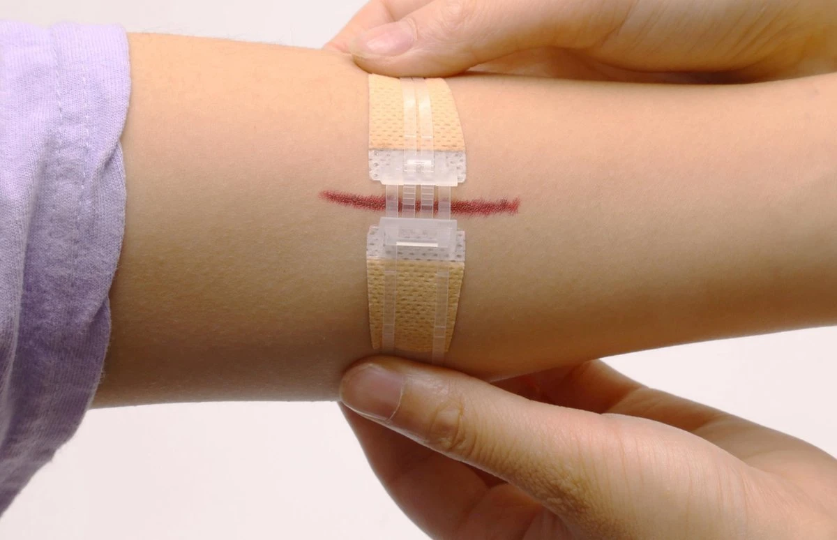 QuickStitch Hechtpleister – Naaldloze Hechting – Pleister Voor Diepe Wonden - Pleisters – Zelf Hechtpleister – Snelle Manier Om Wonden Af Te Sluiten – 3 Stuks 8 QuickStitch Hechtpleister – Naaldloze Hechting – Pleister Voor Diepe Wonden - Pleisters – Zelf Hechtpleister – Snelle Manier Om Wonden Af Te Sluiten – 3 Stuks - Afbeelding 8