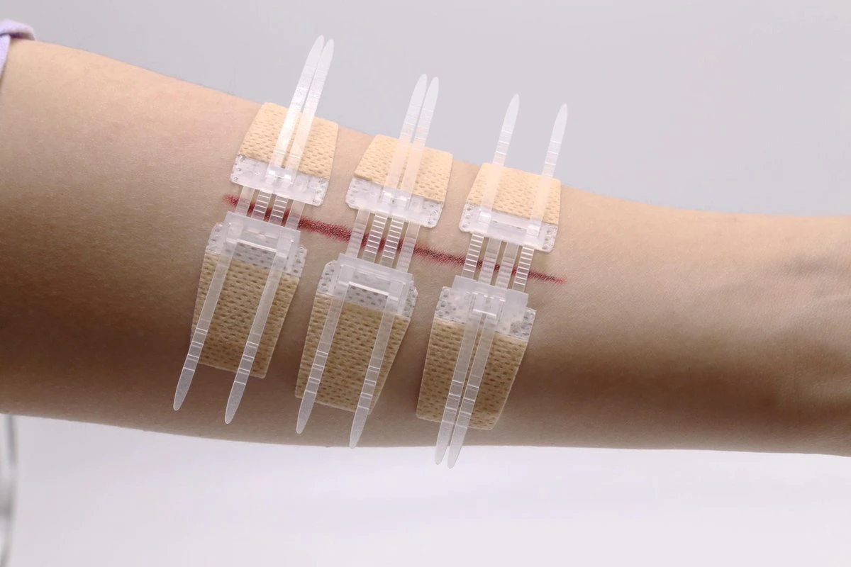 QuickStitch Hechtpleister – Naaldloze Hechting – Pleister Voor Diepe Wonden - Pleisters – Zelf Hechtpleister – Snelle Manier Om Wonden Af Te Sluiten – 3 Stuks 6 QuickStitch Hechtpleister – Naaldloze Hechting – Pleister Voor Diepe Wonden - Pleisters – Zelf Hechtpleister – Snelle Manier Om Wonden Af Te Sluiten – 3 Stuks - Afbeelding 6