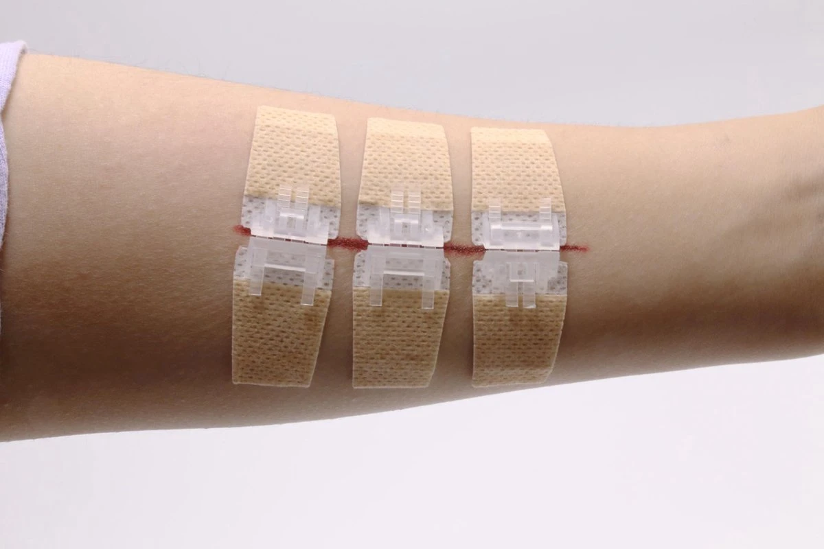 QuickStitch Hechtpleister – Naaldloze Hechting – Pleister Voor Diepe Wonden - Pleisters – Zelf Hechtpleister – Snelle Manier Om Wonden Af Te Sluiten – 3 Stuks 7 QuickStitch Hechtpleister – Naaldloze Hechting – Pleister Voor Diepe Wonden - Pleisters – Zelf Hechtpleister – Snelle Manier Om Wonden Af Te Sluiten – 3 Stuks - Afbeelding 7