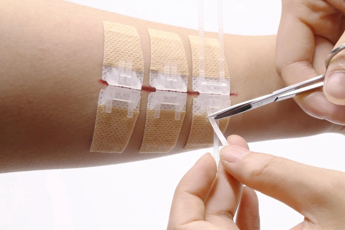 QuickStitch Hechtpleister – Naaldloze Hechting – Pleister Voor Diepe Wonden - Pleisters – Zelf Hechtpleister – Snelle Manier Om Wonden Af Te Sluiten – 3 Stuks 4 QuickStitch Hechtpleister – Naaldloze Hechting – Pleister Voor Diepe Wonden - Pleisters – Zelf Hechtpleister – Snelle Manier Om Wonden Af Te Sluiten – 3 Stuks - Afbeelding 4