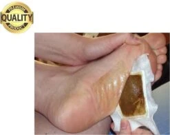 NEW GOLD Detox Voetpleisters Set 20 Stuks Bekend Van TV | Helpt Tegen Depressie, Futloosheid, Irritatie, Gewichtstoename En Meer Lichamelijke Klachten | Voetenpads Ontgiften Het Lichaam | Ontgiftende Voeten Pleisters | Voet Pads | Voetenpleisters 10 NEW GOLD Detox Voetpleisters Set 20 Stuks Bekend Van TV | Helpt Tegen Depressie, Futloosheid, Irritatie, Gewichtstoename En Meer Lichamelijke Klachten | Voetenpads Ontgiften Het Lichaam | Ontgiftende Voeten Pleisters | Voet Pads | Voetenpleisters -Winkel Voor Ehbo-Apparatuur 1200x951